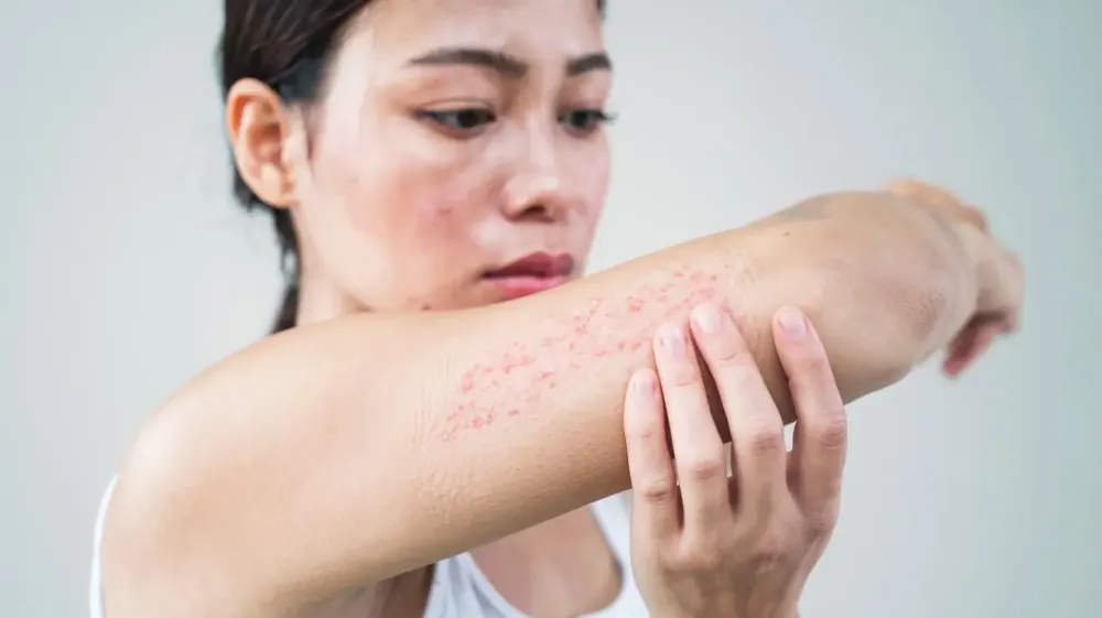 Sensitivity and Irritation: When Your Skin Gets Moody