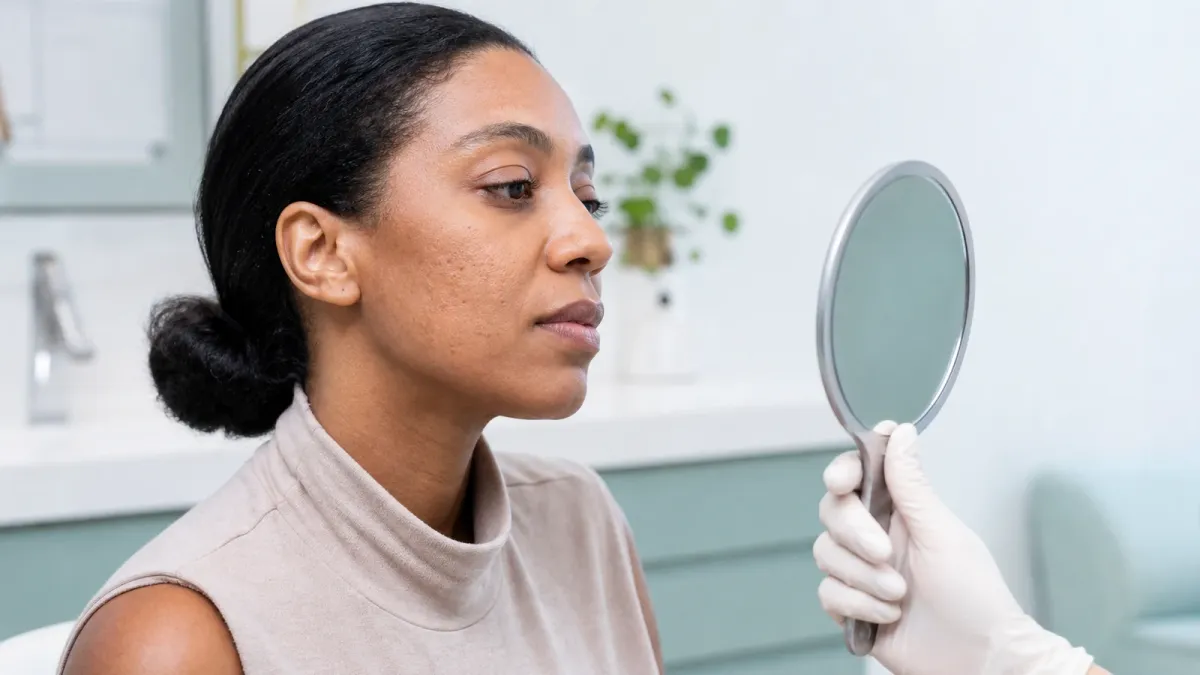Dermatology consultation comparing depressed acne scars and flat post-acne marks in natural light