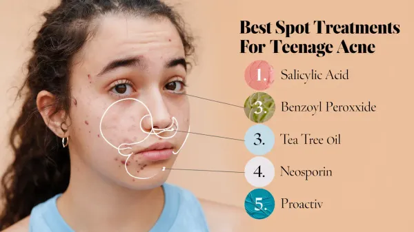 Best Spot Treatments for Teenage Acne