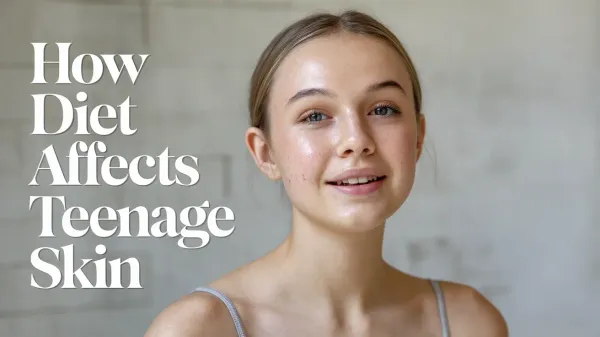 How Diet Affects Teenage Skin