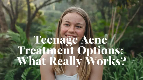 Teenage Acne Treatment Options